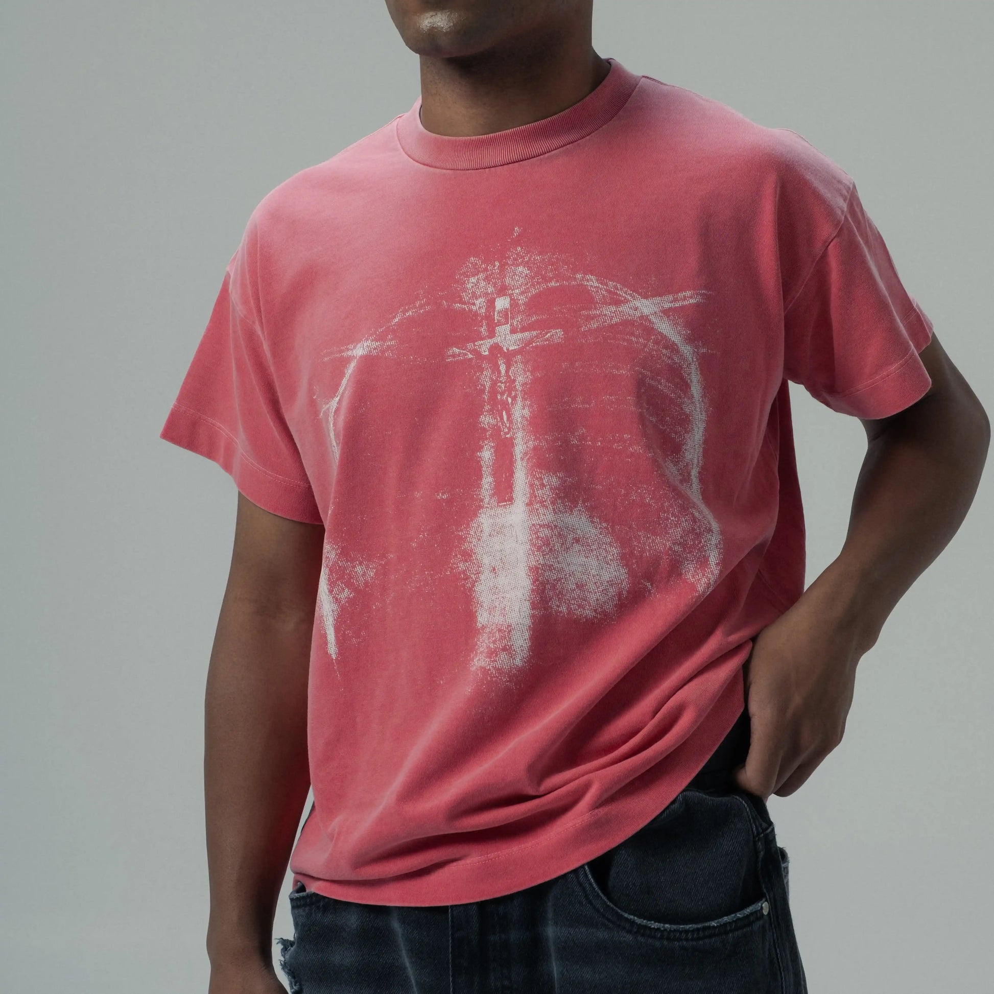 RADIOGRAPHIE TEE