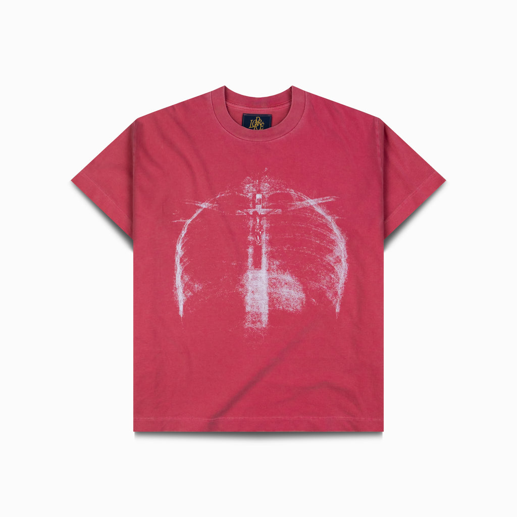 RADIOGRAPHIE TEE